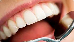 Burneston Dental Surgery,Guildford-whiten