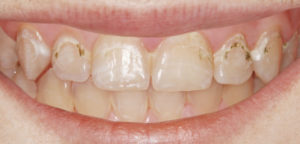 Icon - Burneston Dental, Dentist in Guildford