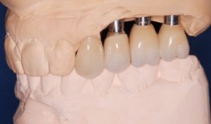 Burneston dental, your Dentist in Guildford