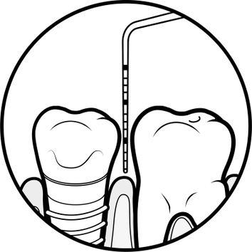 Process one assess
